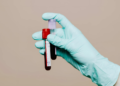 Milhares de mulheres podem estar com anemia após novo limite no sangue