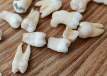 Especialistas ligam problemas dentários a maiores riscos de morte precoce