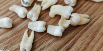 Especialistas ligam problemas dentários a maiores riscos de morte precoce