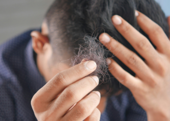 Entenda motivo do Minoxidil revolucionar tratamento contra queda de cabelo