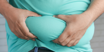 Infográfico aponta causas da alta da obesidade entre brasileiros