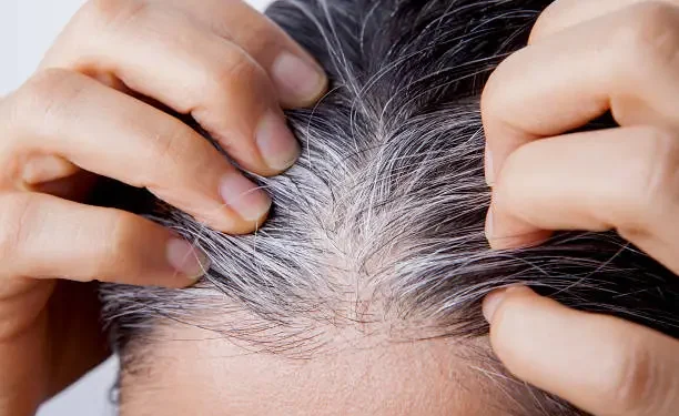 Cabelo Branco - Reprodução/iStock