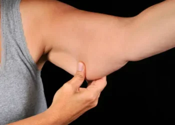 Flacidez do Braço - Reprodução/iStock