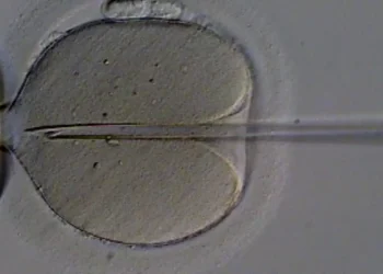 Confusão em fertilização resulta em mulher dando à luz filho de outra - Imagem: Agência Brasil