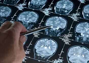 Essas doenças causam deterioração cerebral rápida e são sempre fatais