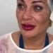 Andressa teria se arrependido da cirurgia, aponta portal de notícias.