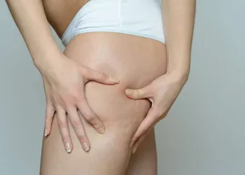 Flacidez nas coxas - Reprodução/iStock