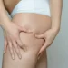 Flacidez nas coxas - Reprodução/iStock