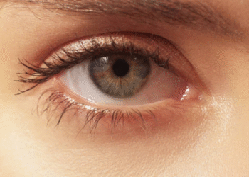 Foto: iStock