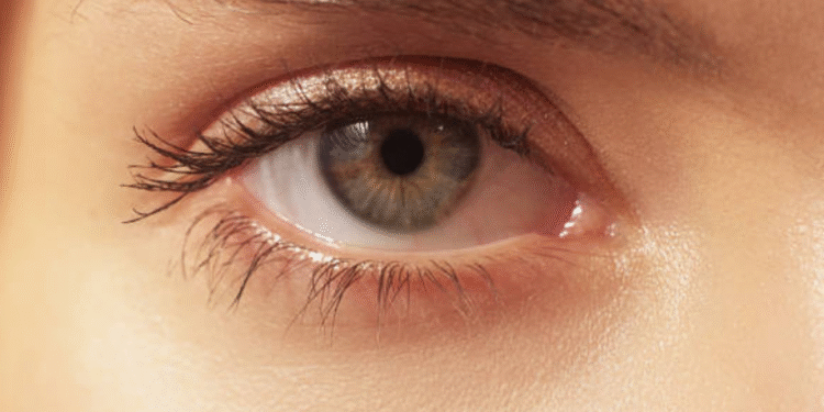 Foto: iStock