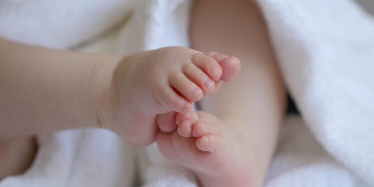 Síndrome de Moebius impede bebê de sorrir; entenda o caso - Imagem: Pixabay