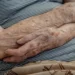 Cientistas descobriram um novo sintoma da doença de Alzheimer - Imagem: Rafa Neddermeyer/Agência Brasil