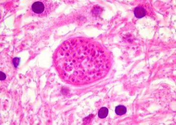 Toxoplasma gondii é causador da toxoplasmose em humanos
Divulgação/Unicamp