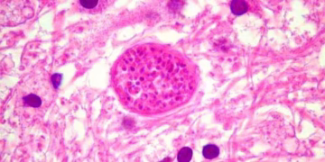 Toxoplasma gondii é causador da toxoplasmose em humanos
Divulgação/Unicamp