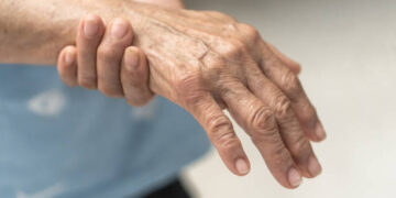 Parkinson - Reprodução/iStock
