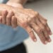 Parkinson - Reprodução/iStock