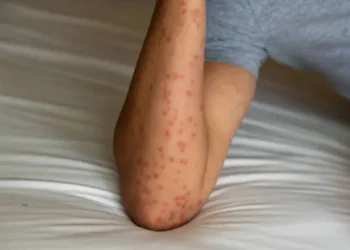 Mosquitos - Reprodução/iStock