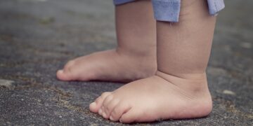 Seus pés estão inchando? Saiba o que está acontecendo com você - Imagem: Pixabay
