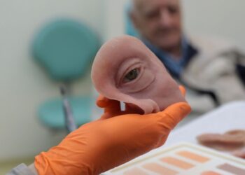 Próteses faciais gratuitas restauram rostos após câncer