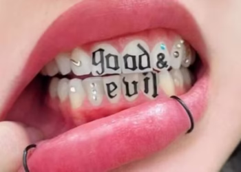 Tatuagem dentária - Reprodução