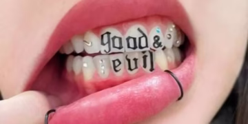 Tatuagem dentária - Reprodução
