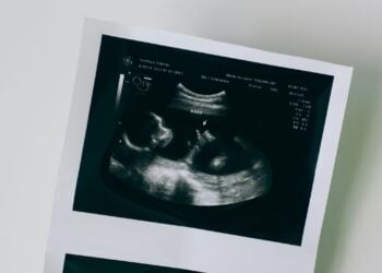 Bilionários correm para criar bebês projetados com algoritmos