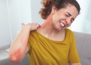 Alerta extremo! Entenda a anafilaxia que pode levar ao colapso