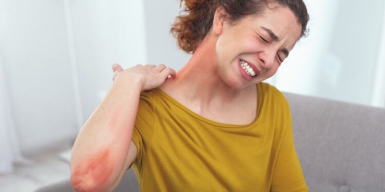 Alerta extremo! Entenda a anafilaxia que pode levar ao colapso
