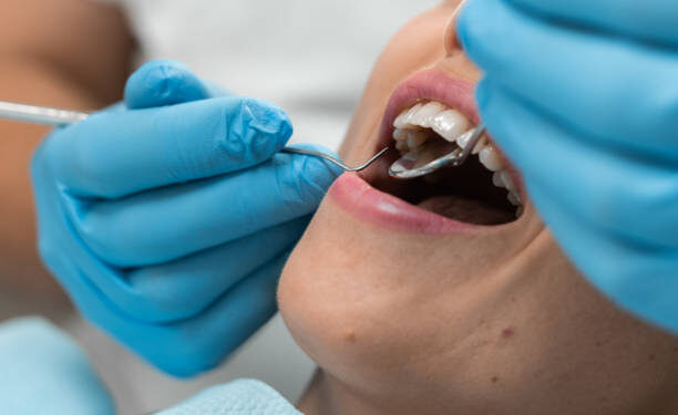 Obturações no dente