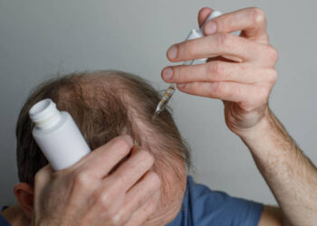 Minoxidil - Reprodução/iStock