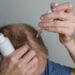 Minoxidil - Reprodução/iStock