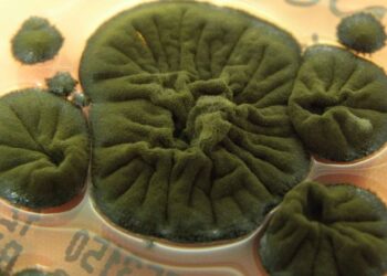 Cladosporium sphaerospermum , cultivado no Centro Hospitalar Universitário de Coimbra, em Portugal. (Rui Tomé/Atlas de Micologia