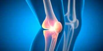 Osteoporose - Reprodução/iStock