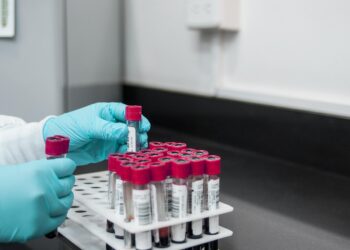 Apenas uma mulher tem esse tipo de sangue considerado raríssimo; saiba motivo - Imagem: Pixabay