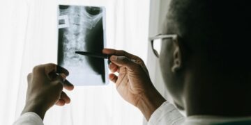 Tratamento inovador para lesões na medula entra em fase de estudo no Brasil