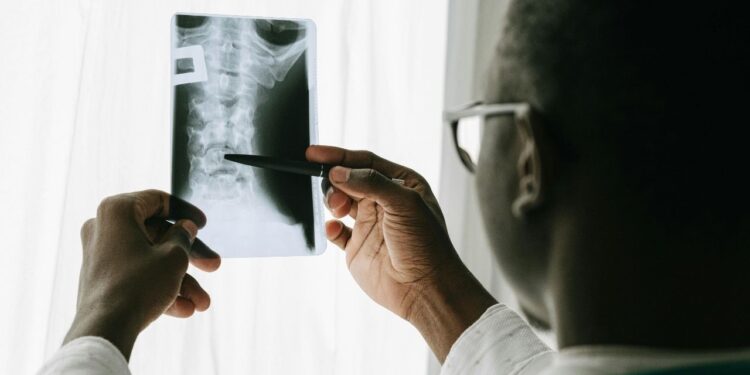 Tratamento inovador para lesões na medula entra em fase de estudo no Brasil