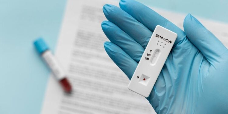 Chegam autotestes que podem transformar combate às ISTs
