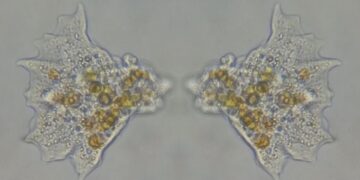Alerta urgente! Amebas que podem matar estão se espalhando no mundo