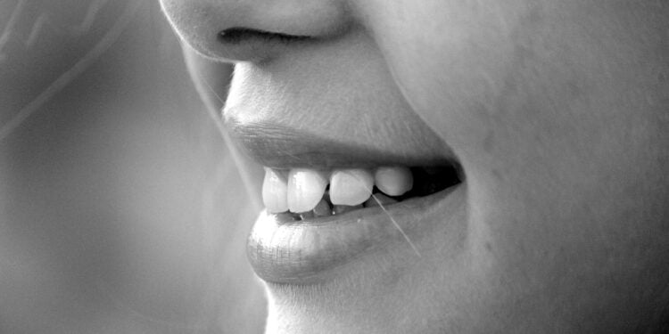 Fita de clareamento dental muito utilizado é proibido com urgência - Imagem: Pixabay