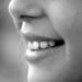 Fita de clareamento dental muito utilizado é proibido com urgência - Imagem: Pixabay