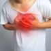 Infarto - Reprodução/iStock