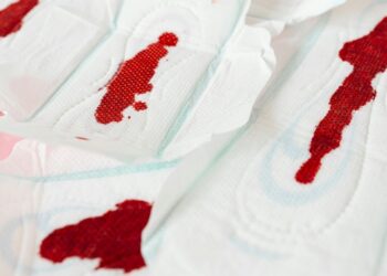 Deficiência de ferro aparece associada a ciclos menstruais intensos