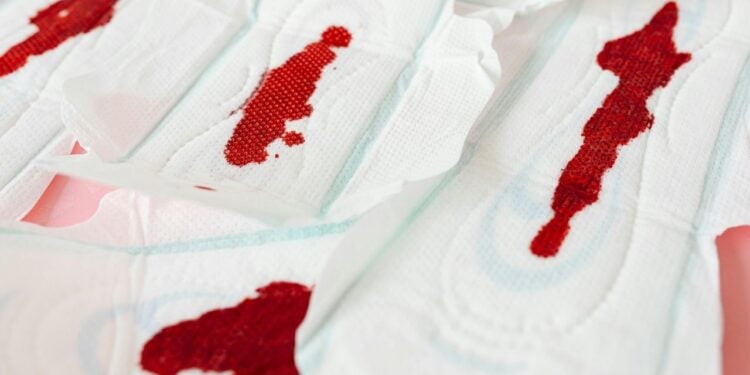 Deficiência de ferro aparece associada a ciclos menstruais intensos