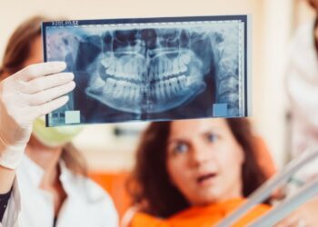 Dentes do siso podem ajudar a regenerar coração cérebro e ossos