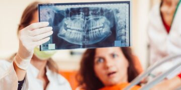 Dentes do siso podem ajudar a regenerar coração cérebro e ossos