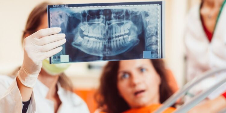 Dentes do siso podem ajudar a regenerar coração cérebro e ossos