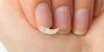 Unhas - Reprodução/iStock