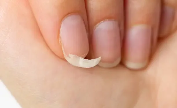 Unhas - Reprodução/iStock