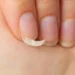 Unhas - Reprodução/iStock