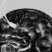Depressão poderá ser curada com implante cerebral do tamanho de uma amora